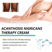Acanthosis Nigricans Therapy Cream 50g