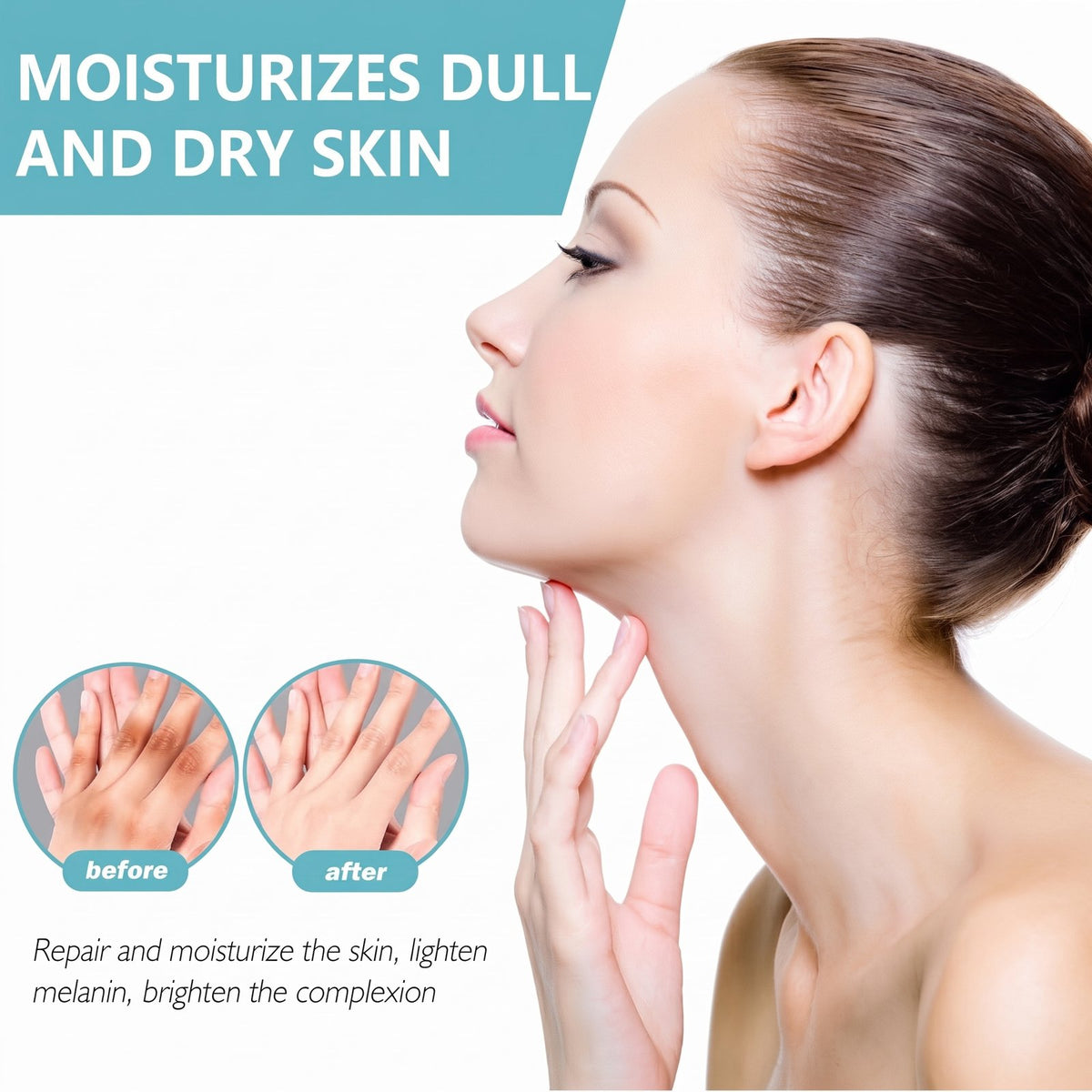 Acanthosis Nigricans Therapy Cream 50g