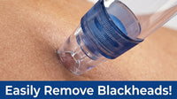 Blackhead Remover Pore Cleaning Vacuum Device